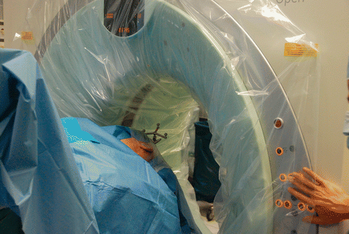 Figure 3. The sterile-draped patient with the skull reference array fixed in place undergoing the intraoperative CT scan.