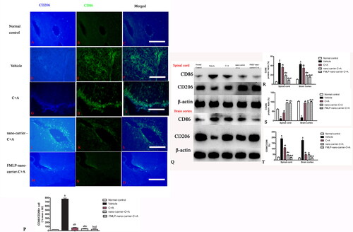 Figure 11. Immunofluorescence staining (A–P) and western blotting (Q–T) showing the effects of C + A compounds on CD206 (blue) and CD86 (green) expression in microglia. a, p < .05 vs. normal control group; b, p < .05 vs. vehicle group; c, p < .05 vs. C + A group; d, p < .05 vs. nano-carrier C + A group.