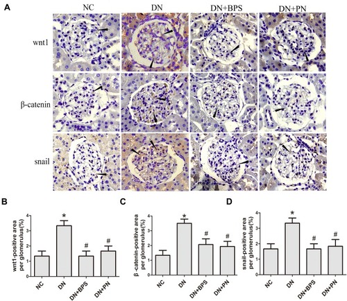 Figure 8 Effects of PN treatment on expression of wnt1, β-catenin, and snail in diabetic rats detected by immunohistochemistry staining (magniﬁcation 400×). Representative photomicrographs of immunostaining for wnt1, β-catenin, and snail (A) in kidney sections. Semiquantitative analyses of immunostaining for wnt1 (B), β-catenin (C) and snail (D) per glomerulus. PN and BPS were administered once daily by oral garage for 12 weeks. Results were expressed as the mean ± SEM. The arrow represents protein expression of wnt1, β-catenin, and snail in diabetic rats glomerular.*P<0.05 vs NC; #P<0.05 vs DN.