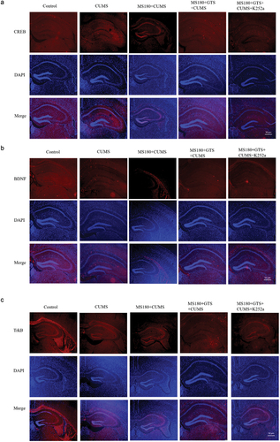 Figure 4. Immunofluorescence assay of the altered hippocampal levels of CREB, BDNF, and TrkB among different groups. All scale bars were × 50 µm. (a) Immunofluorescence assay of the altered hippocampal levels of CREB among different groups. (b) Immunofluorescence assay of the altered hippocampal levels of BDNF among different groups. (c) Immunofluorescence assay of the altered hippocampal levels of TrkB among different groups.