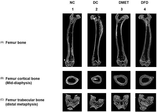 Figure 1. Micro-CT images of rat femurs in 2 D. (1) The NC rats had a thick layer of cortical bone surrounding dense bone trabeculae in the proximal and distal femur. (2) The DC rats display cortical osteopenia in the femoral diaphysis [indicated by white arrow] and trabecular bone loss in the distal femur. (3–4) Cortical bone thickness and density of bone trabeculae increased in the DMET and DFD rats. Images are representative of three animals per experimental group.