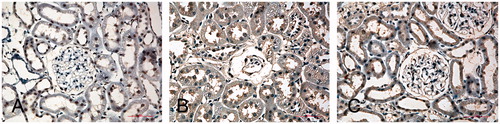 Figure 3. Light photomicrographs of eNOS immunohistochemical staining of the kidney (400×). (A) A control rat, (B) a diabetic rat and (C) a Puerarin-treated rat. The expression of eNOS was virtually absent in glomerular endothelial cells, but positive in some tubular cells in the kidney of normal rat (A), while the diabetic kidney showed enhanced eNOS expression in glomerular endothelial cells (B), which represented the major source of eNOS especially with severe glomerulosclerosis. In addition, there was also positivity for eNOS next to injured capillaries that might originate from other cells, such as mesangial or invading inflammatory cells. In contrast, the tubular eNOS expression only slightly increased compared with kidneys of normal rat.