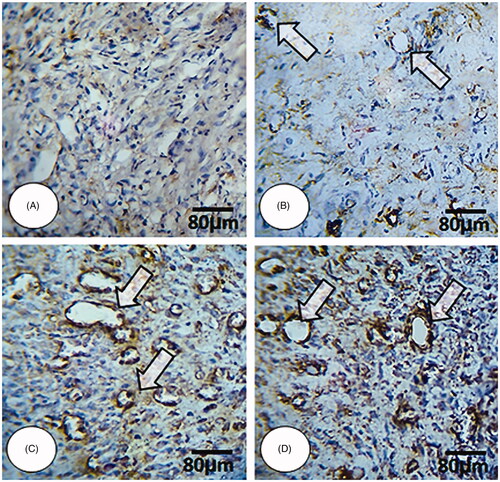 Figure 3. Immunohistochemical staining for angiogenesis:; (A) NCG group, (B) MG group, (C and D) 2 and 4% ZMEO-treated groups. See elevated angiogenesis in ZMEO-treated group (arrows) on day 7 after wound induction. CD 31 staining, 400×.