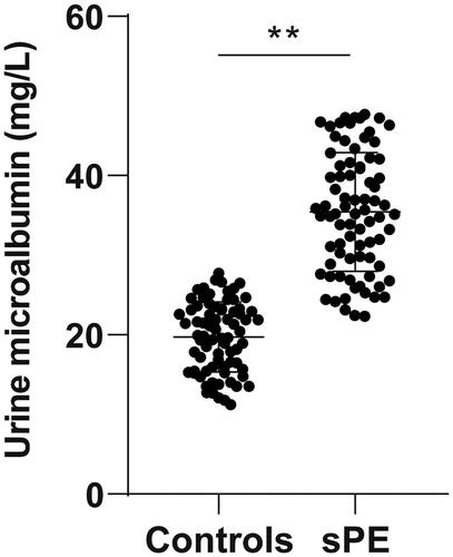 Figure 1. UmA level is increased in sPE patients. UmA level in urine samples of sPE patients and healthy controls was measured by means of ELISA. Data were described as mean ± standard deviation. The independent sample t test was applied to compare the difference between groups. **p < 0.01.