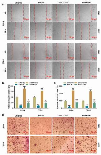 Figure 8. Co-transfection of siSIDT2 and miR-31-5p I regulated cell migration and invasion