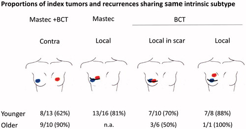 Figure 1. Correlation between subtypes of the index tumor (marked with blue) and contralateral breast cancer (Contra, marked with red) or local recurrence (Local, marked with red). Surgical treatment of the index tumor was either mastectomy (Mastec) or breast conserving surgery + radio therapy (BCT). Local recurrence (Local) was subdivided into three subgroups: if primary treatment was mastectomy, if primary treatment was BCT and recurrence was developed in the scar or if primary treatment was BCT and recurrence was most likely outside the scar. Younger: ≤45 years, older >45 years.