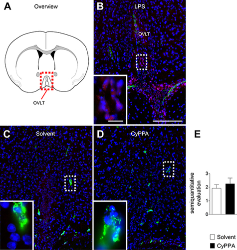 Figure 7 Analyses of CyPPA-mediated induction of hypothalamic nuclear STAT3 translocation 2 hours after treatment with either solvent or CyPPA (15 mg/kg). Immunohistochemical detection of STAT3 (red) in the vascular organ of the lamina terminalis (OVLT; schematic neuroanatomical overview in A) depicted as nuclear signals (pink) in an LPS-treated animal as positive control with typical distribution (B). Representative microphotographs of solvent (C) and CyPPA treatment (D) with high-magnification insets of areas highlighted with dotted squares. For better orientation, von Willebrand factor (green) was used to label endothelial cells. Semiquantitative evaluation of the immunohistochemistry between solvent and CyPPA groups (at least two brain sections per animal, six animals per group) is shown in E. Bars in B apply to all overview microphotography and represent 100 µm, 10 µm for inserts.