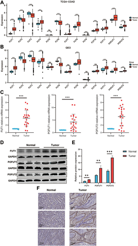 Figure 1 Expression of FUTs and MUC2 in COAD. (A and B) Differential expression of FUTs between COAD tissues and normal colon tissues in the TCGA cohort (A) and GSE39582 cohort (B). (C and D) Differential expression of FUT1, FUT12, FUT13 in COAD tissues and normal colon tissues by RT-qPCR (C) and Western blot (D). (E) Quantification of Figure 1D. (F) Differential expression of POFUT1 in COAD tissues and normal colon tissues by immunohistochemistry. (**P<0.01, ***P<0.001, ns: P>0.05).