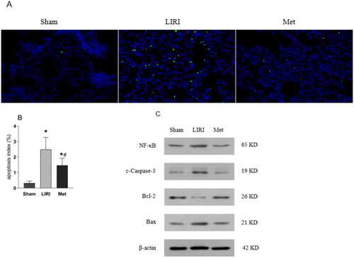 Figure 5. Metformin attenuated lung tissue apoptosis in rats after lung transplantation (A) merged immunofluorescence images showing apoptosis in each group (magnification, 200×). (B) The percentage of apoptotic cells in each group was determined. (C) Representative Western blot images are shown. *p < 0.05, vs. the sham group; #p < 0.05, vs. the LIRI group. Display full size, sham group; Display full size, LIRI group; Display full size, Met group.