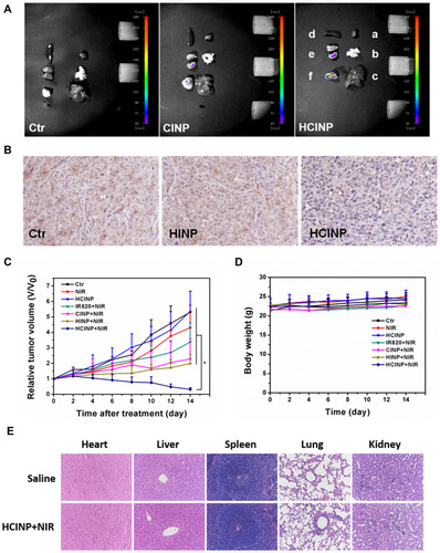 Figure 8 Enhanced anti-tumor effect of HCINPs. (A) Measurement of the in vivo targeting effect of HCINPs (a: heart, b: lung, c: liver, d: spleen, e: kidney, f: tumor). (B) Expression of HIF-1α in tumor tissues (200×). The mean positive area of the Ctr group, HINP group, and HCINP group were 1522, 1503, and 1092, respectively. (C) Relative tumor-volume curves of different groups of MV3 tumor-bearing mice. *P < 0.05, versus the HCINP group. (D) Body weights of mice measured during the 14 observation days in different groups. (E) HE-staining images of major organs collected from the saline (Normal) and HCINPs with NIR irradiation groups (200×).