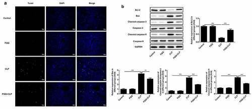 Figure 3. PQQ treatment mitigated sepsis-induced cell apoptosis of liver tissues. (a) Apoptosis of liver tissue cells was detected with TUNEL staining. (b) Expressions of Bcl-2, Bax, Cleaved caspase3 and Cleaved caspase9 were determined using western blotting analysis