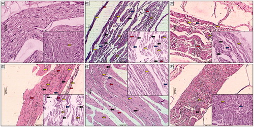 Figure 4. Effect of chronic treatment of hesperidin and insulin on histopathological analysis of sciatic nerve in STZ-induced diabetic neuropathy. Photomicrographs of sections of sciatic nerve from rats stained with H&E. Sciatic nerve microscopic image of (A) normal rat, (B) STZ control rat, (C) insulin (10 IU/kg, s.c.), (D) hesperidin (50 mg/kg, p.o.), (E) hesperidin (100 mg/kg, p.o.), and (F) hesperidin (100 mg/kg, p.o.) and insulin (10 IU/kg, s.c.) combination-treated rats (microscopic examination under 400 × light microscopy).