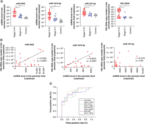 Figure 2. Diagnostic relationship between the level of candidate miRNAs or 16S rDNA and severe chorioamnionitis.(A) Expression levels of each candidate miRNA and the copy numbers of 16S rDNA in pregnant women divided into three groups: Blanc’s classification stages II–III (group II–III: n = 37, red circles); Blanc’s classification stages 0–I (group 0–I: n = 11, blue circles); and healthy pregnant women between 15 and 17 gestational weeks (control: n = 15, gray circles). Data are expressed as the median ± 95% CI. Thick and thin bars indicate the median and 95% CI, respectively. Statistical differences among the groups were assessed using Dunn’s multiple comparison test. (B) Correlation between miRNA expression and 16S rDNA copy number in amniotic fluid samples from 37 pregnant women with Blanc’s classification stages II–III. r indicates the correlation index. (C) Diagnostic and predictive accuracies of miRNA levels and 16S rDNA copy number for chorioamnionitis. Blue, green, yellow and purple lines indicate receiver operating characteristic curves for 16S rDNA, miR-191-5p, miR-1915-5p and miR-4535, respectively.*p < 0.01; **p < 0.0001.