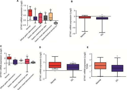 Figure 3 Analysis of STYK1 mRNA expression in GC tissues and normal tissues based on public databases.Notes: (A) Cho gastric statistics, (B) Cui gastric statistics, (C) D’Errico gastric statistics, (D) Wang gastric statistics. All data are from Oncomine. (E) STYK1 expression analysis based on TCGA database. *P<0.05; **P<0.01.Abbreviations: GC, gastric cancer; TCGA, The Cancer Genome Atlas.