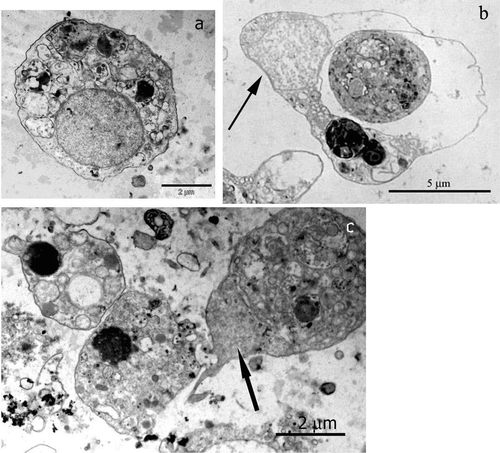 Figure 4 TEM micrographs of isolatedP. ficiformis cells: a, an archeocyte; b, a spherulous cell with a peripheral nucleus (arrow) and a big vacuole.