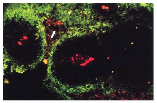 Figure 2 Fluorescence microscopic image of a tumor section after staining for hypoxia (green) and vessels (red).