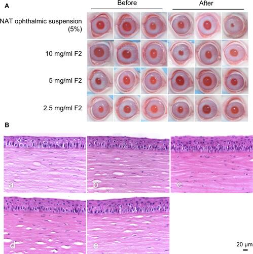 Figure 8 (A) Ocular surface changes after different drug administrations. (B) Photomicrography of the histopathological study of the examined rabbit corneas.