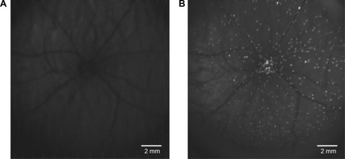 Figure 1 The DARC in vivo retinal image.