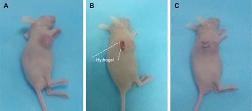 Figure 2 Process of peritumoral implantation of hydrogel.Notes: (A) A mouse bearing a 4T1 cell-xenografted tumor is anesthetized; (B) a skin incision is made beside the tumor mass and the hydrogel is implanted; and (C) the incision is sutured.