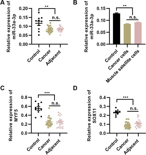 Figure 1. miR-33a-3p expression is downregulated in patients with pharyngeal cancer-induced dysphagia (PCD). (A) miR-33a-3p expression is downregulated in tumor tissues and adjacent healthy tissues in patients with PCD. (B) miR-33a-3p expression is downregulated in tumor cells and muscle satellite cells collected from patients with PCD, n = 10 for each group. **P < 0.01, n.s., not significant. One-way analysis of variance followed by Tukey’s multiple comparisons test. Error bars indicate SEM.