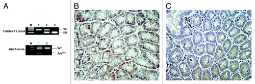 Figure 1. (A) PCR genotyping of Cables1 and Apc. In the upper panel, lanes 1, 2, and 3 represent the Cables1 wild-type, heterozygous, and homozygous genotypes, respectively. WT, wild-type fragment (~300 bp); KO, knockout fragment (~200 bp). In the lower panel, lanes 1 and 2 represent the ApcMin/+ and Apc wild type genotypes, respectively. WT fragment (~600 bp); ApcMin fragment (~340 bp). (B) Intact nuclear Cables1 expression by immunohistochemistry in Cables1+/+ ApcMin/+ mouse intestinal epithelial cells. (C) Loss of nuclear Cables1 expression by immunohistochemistry in Cables1−/−ApcMin/+ mouse intestinal epithelial cells. A few inflammatory cells retain Cables1 expression.