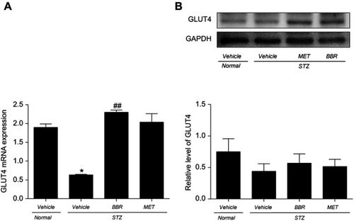 Figure 5 Effect of BBR on skeletal muscle GLUT4 mRNA (A) and protein (B) expression in T2DM rats. Data were expressed as mean ± SEM (n=3). *p<0.05 vs. NC group; ##p<0.01 vs. T2DM control group.