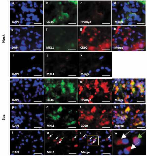 Figure 3. Localization of PPARγ2, MKL1, and mesenchymal stem cell (MSC) markers in the vascular wall. Double-immunostaining for CD44 and PPARγ2 (a–d), MKL1 and CD90 (e–h), and DAPI and MKL1 (i–k) in the abdominal aortic aneurysm (AAA)-neck wall. Double-immunostaining for CD44 and PPARγ2 (l–o), MKL1 and CD90 (p–s), and DAPI and MKL1 (t–v) in the AAA-sac wall. The squared area in the (v) panel is magnified in the (w) panel. The white and green arrows indicate the extranuclear and intranuclear regions, respectively. Scale bar = 50 µm. Neck (n = 5) and sac (n = 5) walls.