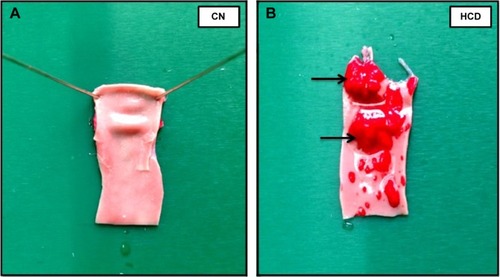 Figure 12 Photographs of aortic arches stained with Sudan IV dye (sudanophilia).