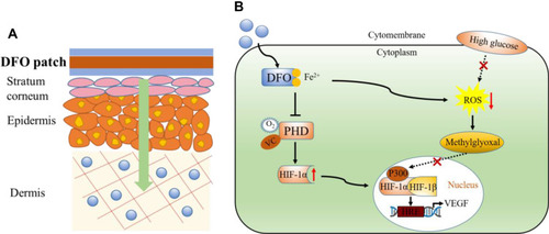 Figure 4 Development of a transdermal drug delivery system for DFO. (A) DFO patch is administered through transdermal drug delivery system into the dermis to perform its functions. (B) Functional diagram of DFO and its regulation in the HIF-1a signaling pathway.