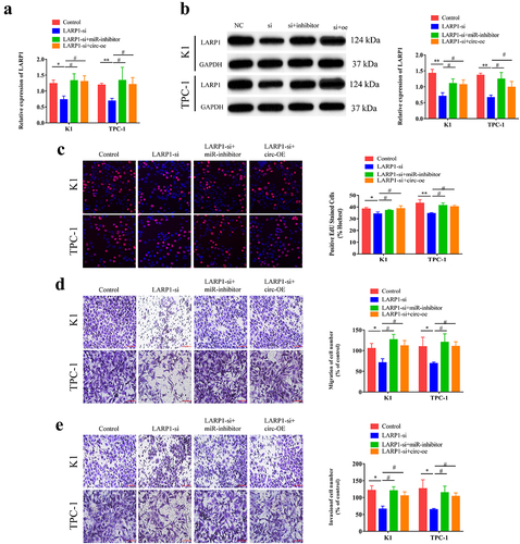 Figure 5. Circ-CCDC66 was involved in the development of PTC through the miR-129-5p/LARP1 axis.