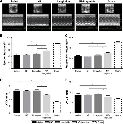 Figure 4 Echocardiographic assessments.Notes: (A) Representative echocardiographic images from each group 4 weeks after treatment. The LVEF (B), LVFS (C), LVIDs (D) and LVIDd (E) were assessed via two-dimensional echocardiography. Data are shown as mean ± SEM, *P<0.05. NP-liraglutide: liraglutide loaded in PLGA–PEG NPs.Abbreviations: LVEF, left ventricular ejection fraction; LVFS, left ventricular fractional shortening; LVIDd, left ventricular internal diastolic dimension; LVIDs, left ventricular internal systolic dimension; NP, nanoparticle; PEG, poly(ethylene glycol); PLGA, poly(lactic-co-glycolic acid); SEM, standard error of the mean.