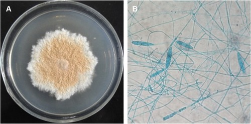 Figure 1 Morphology of Arthroderma fulvum (strain HT77).Notes: (A) Macroscopic morphology (PDA, 28°C, 9 days) and (B) microscopic morphology (×400, stained with lactophenol cotton blue).Abbreviation: PDA, potato dextrose agar.