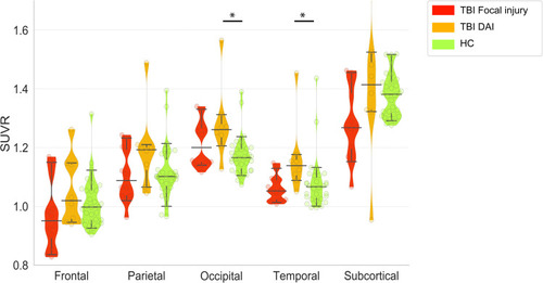 Figure 2 Violin and whisker plot shows 5% and 95% confidence intervals (whiskers) and medians of the mean SUVRs of each region of interest in patients with focal injury (red) or DAI (orange) and the healthy controls (green). Mean SUVR in DAI patients in the occipital and temporal cortices were significantly higher than those of healthy controls. *p<0.05, Wilcoxon rank sum test, FWE.