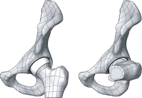 Figure 2. Anterolateral view of the CAD model of a 48-mm hip resurfacing reduced by 5%. The femoral offset implant with 165° head coverage in situ, with a cup position of 45° inclina-rose with the patient's femoral tion and 15° anteversion. Left: starting position for flexion movement with a head size. The diagrams in Figure straight leg. Right: end position with an anterior impingement of femoral neck at the acetabular component (flexion angle: 77°).