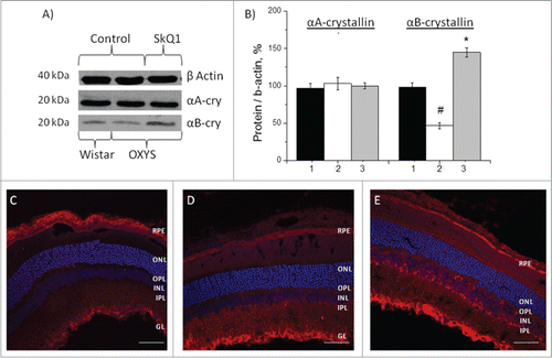 Figure 3. Effects of treatment with SkQ1 on the protein levels of αА- and αВ-crystallin in the retina of OXYS rats. (A) Western blot analysis. (B) The protein gel blot results quantified as a percent of data from untreated age-matched Wistar rats (mean ± SEM), normalized to β-actin from 5 independent experiments. 1: Wistar rats, 2: OXYS rats, 3: OXYS rats treated with SkQ1. #Significant differences between untreated OXYS and Wistar rats (P < 0.05); *a significant effect of treatment with SkQ1 (P < 0.05). Confocal immunofluorescent images depict αB-crystallin (red signal) detected within the retina and RPE in OXYS rats (C) compared to disease-free Wistar (D) rats and (E) SkQ1-treated OXYS rats (250 nmol/kg per day from 1.5 to 4 months of age). Cell nuclei were stained with DAPI (blue). The scale bar: 50 μm. Abbreviations: outer nuclear layer (ONL), outer plexiform layer (OPL), inner nuclear layer (INL), inner plexiform layer (IPL), retinal pigment epithelium (RPE), and ganglion layer (GL).