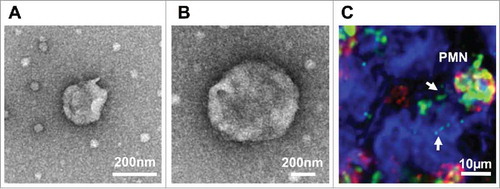 Figure 1. Characterization of PMN-derived EVs. (A-B) PMNs were stimulated with fMLF (1μM) to produce EVs. EVs were isolated by serial centrifugation and analyzed by transmission electron microscopy. (A) A representative EV with the size of exosomes (< 100 nm). (B) A representative microparticle/ectosome with the size of ∼600 nm. (C) PMNs (immunolabeled for CD11b, red and myeloperoxidase, green) release myeloperoxidase-containing EVs (shown by arrows) following adhesion to and migration across IECs (surface stain, blue).