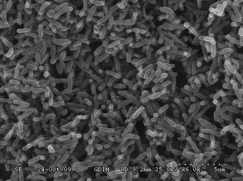 Figure 2. TEM micrographs of strain TAD1 grown on DM agar medium plates after 3 days of incubation.