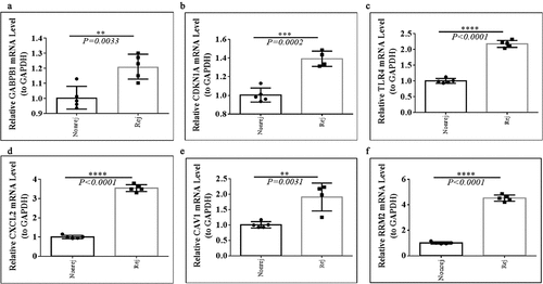 Figure 8. The expression levels of GABPB1, CDKN1A, TLR4, CXCL2, CAV1, and RRM2 between between graft rejection and non-rejection samples from Clinical PBMCs. (a) GABPB1. (b) CDKN1A. (c) TLR4. (d) CXCL2. (e) CAV1. (f) RRM2