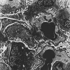Figure 2 Normal glomerulus was seen in Group 1. Capillary (cap), Basal laminae (Bl), pedicels of podocytes (pd). X 7087.