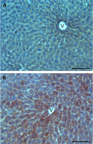 Figure 6 Light microscopy images of liver sections from control (A) and SLN-treated (B) mice; note the large amounts of lipid droplets in B (Oil Red O staining). V: centrilobular vein. Bars, 100 µm.