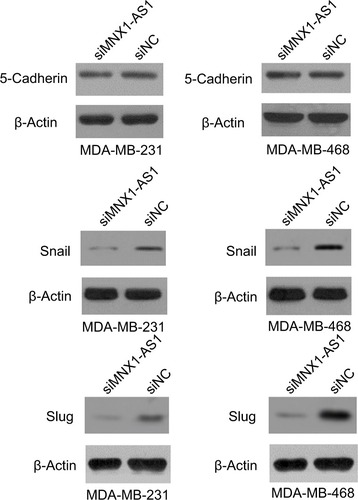Figure 5 lncRNA MNX1-AS1 could promote EMT in BC cells.Notes: The expression of 5-cadherin, slug and snail were measured after lncRNA MNX1-AS1 was suppressed in MDA-MB-231 and MDA-MB-468.Abbreviation: EMT, epithelial–mesenchymal transition.