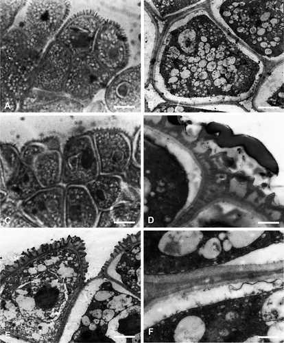 Figure 4. Wall structure in Habenaria gourlieana. A, C. LM & B, D–F. TEM. A. Quadrangular external tetrad. B. Inner grains with exine without reticulum, and wide intine. C. Tetragonal and other types of tetrads. D. Pollen wall (detail), partial muri and pila with pollenkit inside and over. E. External grains of tetrads with reticulum-like exine, pollenkit present among baculae. F. Detail of wall in internal pollen grains with intine and granular exine. Scale bars – 10 μm (A, C); 5 μm (B, E); 0.5 μm (D, F).