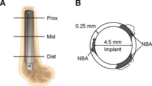 Figure 1 Schematic drawing of the position of the implant and the new bone area calculated around the implant.Notes: (A) Schematic drawing of the distal femur of a rabbit. The implant was inserted into the medullary canal. Lines Prox, Mid, and Dist indicate the proximal, middle, and distal section levels, respectively, for histological evaluation. (B) Schematic representation of the NBA; gray area. The NBA was defined as the gray area within the ring around the implant.Abbreviation: NBA, new bone area.