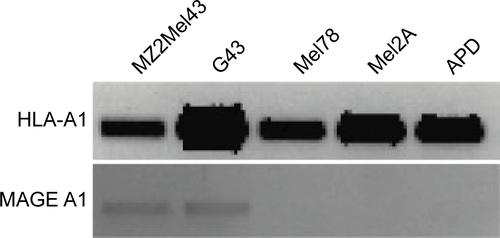 Figure S1 pMHC expression on tumor cell lines.Notes: We determined the expression of MAGE A1 and HLA-A1 individually on the melanoma cell lines in use by PCR. Expression of HLA-A1 is prevalent in all cell lines shown in upper gel row, whereas the lower row shows MAGE A1 peptide expression.Abbreviations: pMHC, peptide:MHC; MHC, major histocompatibility complex; MAGE A1, Melanoma AntiGEn A1; HLA-A1, human leukocyte antigen A1; PCR, polymerase chain reaction.