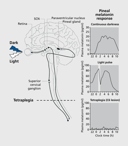 Figure 1. Neuroanatomy of the circadian system. Light is detected by specialized retinal photoreceptors and transduced to the circadian pacemaker in the hypothalamic suprachiasmatic nuclei (SCN) via the monosynaptic retinohypothalamic tract (RHT). SCN efferents project to the pineal gland via the paraventricular nucleus (PVN) and the superior cervical ganglion (SCG). Under normal light-dark conditions, the pineal melatonin rhythm peaks at night during the dark phase with the duration of melatonin production reflecting the scotoperiod (night-duration) (top panel). When the eyes are exposed to light at night however, melatonin production is immediately suppressed, recovering once the light is switched off (middle panel). The “melatonin suppression test” confirms the functional integrity of the retina-RHT-SCN-PVN-SCG-pineal pathway. In individuals in whom the upper spinal cord has been severed, for example in tetraplegie patients, the signal from the SCN cannot reach the pineal gland and no rhythmic production of melatonin is possible (lower panel). Circadian rhythms in other parameters that do not require the SCN-SCG pathway, such as Cortisol and TSH rhythms, remain fully intact in tétraplégie patients.Citation1,Citation2 Adapted from reference 3: Wehr TA, Duncan WC Jr, Sher L, et al. A circadian signal of change of season in patients with seasonal affective disorder. Arch Gen Psychiatry 2001;58:1108-1114. Copyright © American Medical Association 2001; and from reference 4: Zeitzer JM, Ayas NT, Shea SA, Brown R, Czeisler CA Absence of detectable melatonin and preservation of cortisol and thyrotropin rhythms in tetraplegia. J Clin Endocrinol Metab. 2000;85:2189-2196. Copyright © Endocrine Society 2000