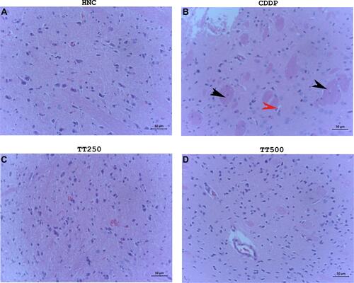 Figure 6 H&E photomicrographs showing histology of brain tissues of (A) HNC, (B) CDDP, (C) TT250 and (D) TT500 groups, respectively. H&E ×400.