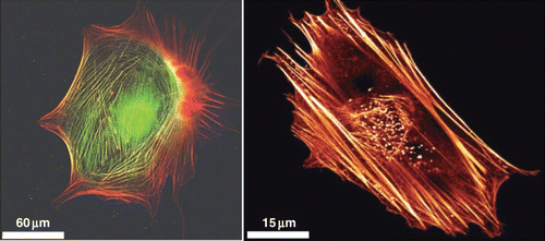 Figure 11. Actin stress fibers in living cells (left side: a fibroblast with labeled myosin (green) and actin (red), right side: a fibroblast with labeled actin) fulfill important tasks like mechanical stabilization. The development of cellular stress fibers is preferred by 2D cell cultures. Images were taken by Thomas Fuhs and Daniel Koch.