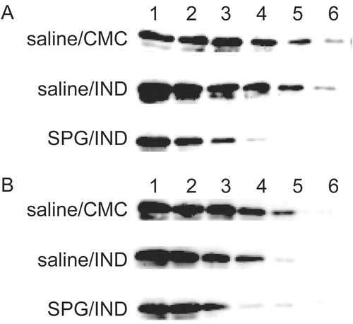 Figure 10.  CYP2E1 protein expression in liver microsomes from SPG/IND-administered mice just before disease. Five-week-old ICR mice (A) and 8-week-old C3H/HeJ mice (B) were administered SPG (100 μg/mouse) or saline IP on Days -5, -3, and -1, and indomethacin (IND, 5 mg/kg) per os from Day 0 to 4. On Days 3 and 4, liver microsomes were obtained and CYP2E1 protein expression was measured by Western blotting. Lane 1, 500 μg/ml; Lane 2, 250 μg/ml; Lane 3, 125 μg/ml; Lane 4, 62.5 μg/ml; Lane 5, 31.25 μg/ml; Lane 6, 15.625 μg/ml.