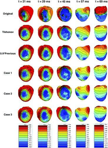 Figure 1. Original and reconstructed epicardial potential maps at five different time instants during the QRS region.