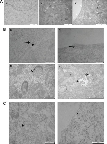 Figure 2 Uptake of Au-NPw, Au-NPp, and Au-NPd in human cancer cells. (A) Transmission electron microscopy images of neuroblastoma cell line cells incubated with 1 mg/L Au-NPw (a), Au-NPp (b), or Au-NPd (c) for 24 hours. (B) Intracellular trafficking of Au-NPw in neuroblastoma cell line cells. NPs are closed to the cell membrane (arrow) (a), enclosed in endocytic vesicles close to the cell membrane (arrow) (b), inside late endosome (arrow) (c), and inside endolysosome (full arrow) and lysosome (dotted arrow) (d). (C) Transmission electron microscopy images of glioblastoma cell line cells incubated with 1 mg/L Au-NPw for 24 hours. Au-NPw are internalized in glioblastoma cells (left) via endocytic vesicles (right).Abbreviations: Au-NPs, gold nanoparticles; Au-NPd, Au-NPs prepared in dextran; Au-NPp, Au-NPs prepared in polyethylene glycol; Au-NPw, Au-NPs in pure deionized water.